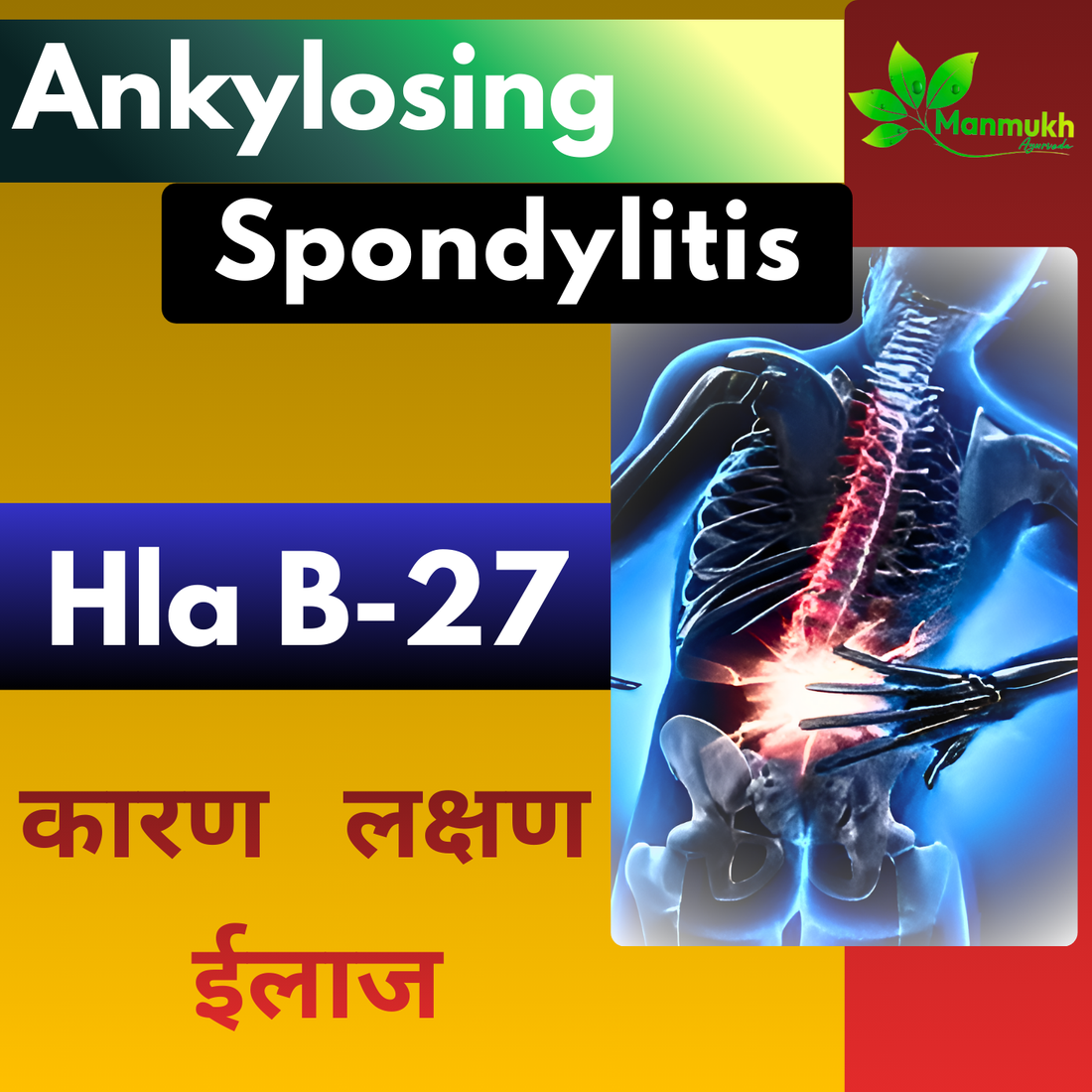 Ankylosing Spondylitis Cause, Symptoms and Treatment