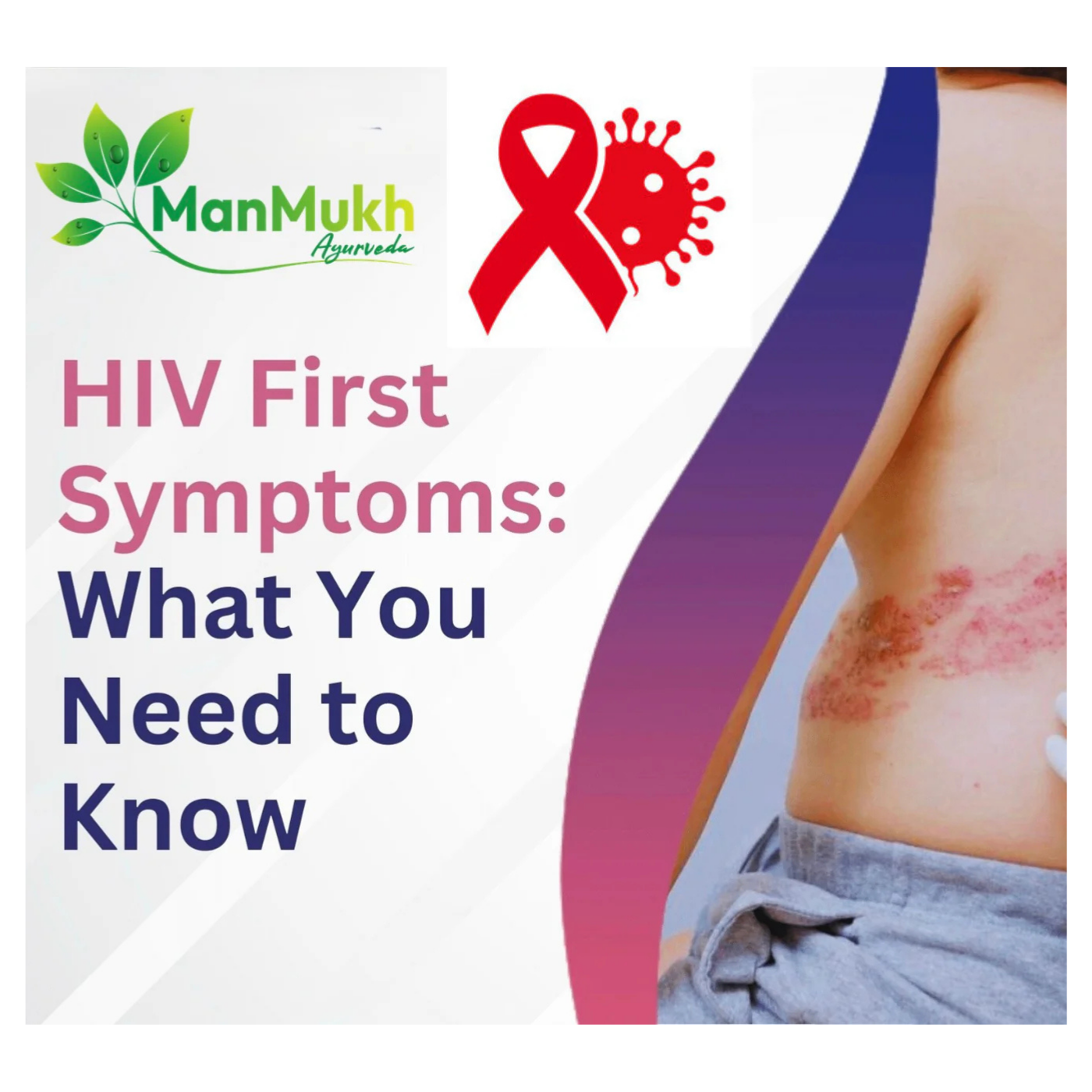 Symptoms Of Hiv/Aids In 1st Stage